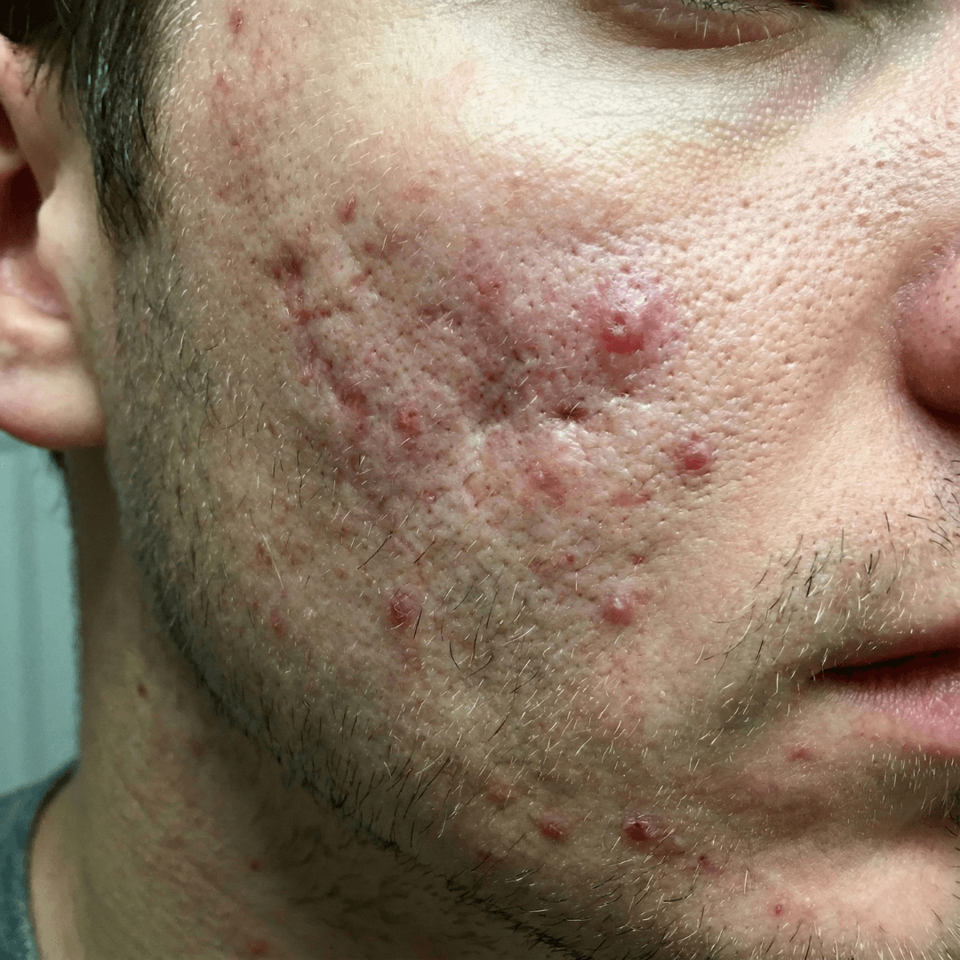 Brian before treatment