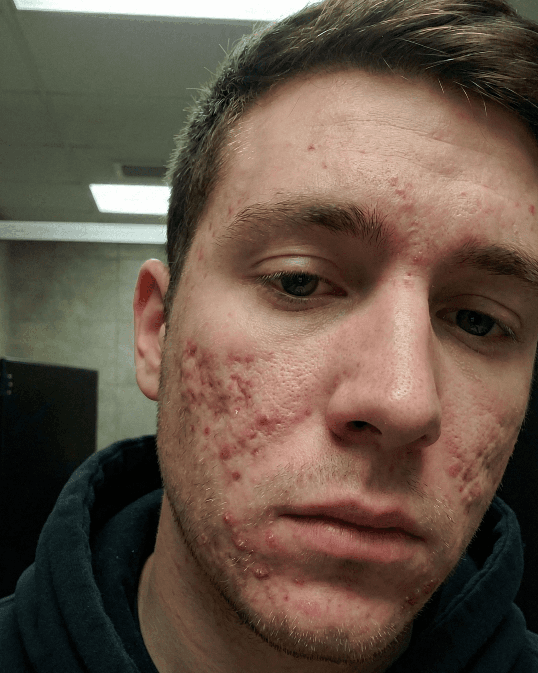 Patient 1 before treatment