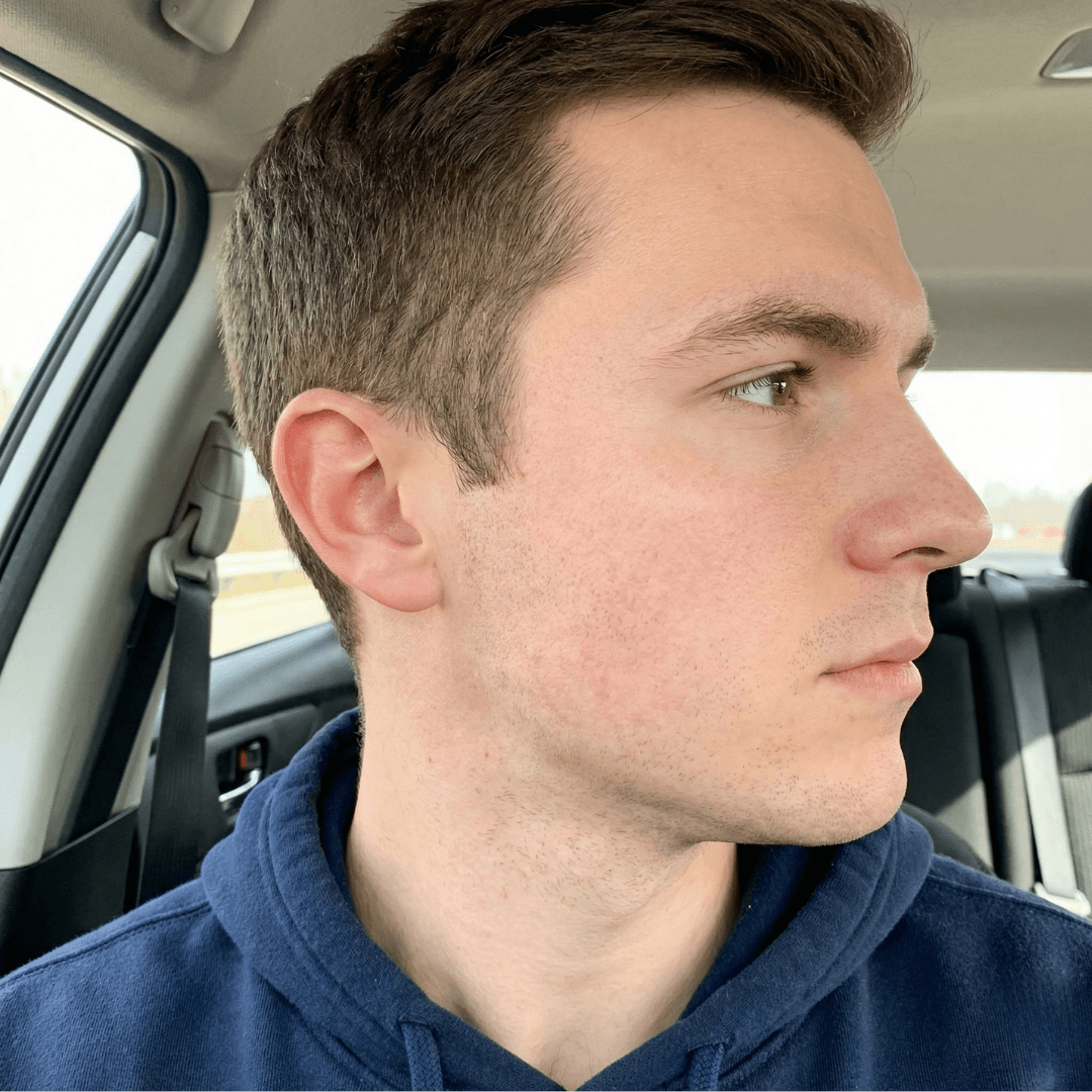 Marcus after treatment